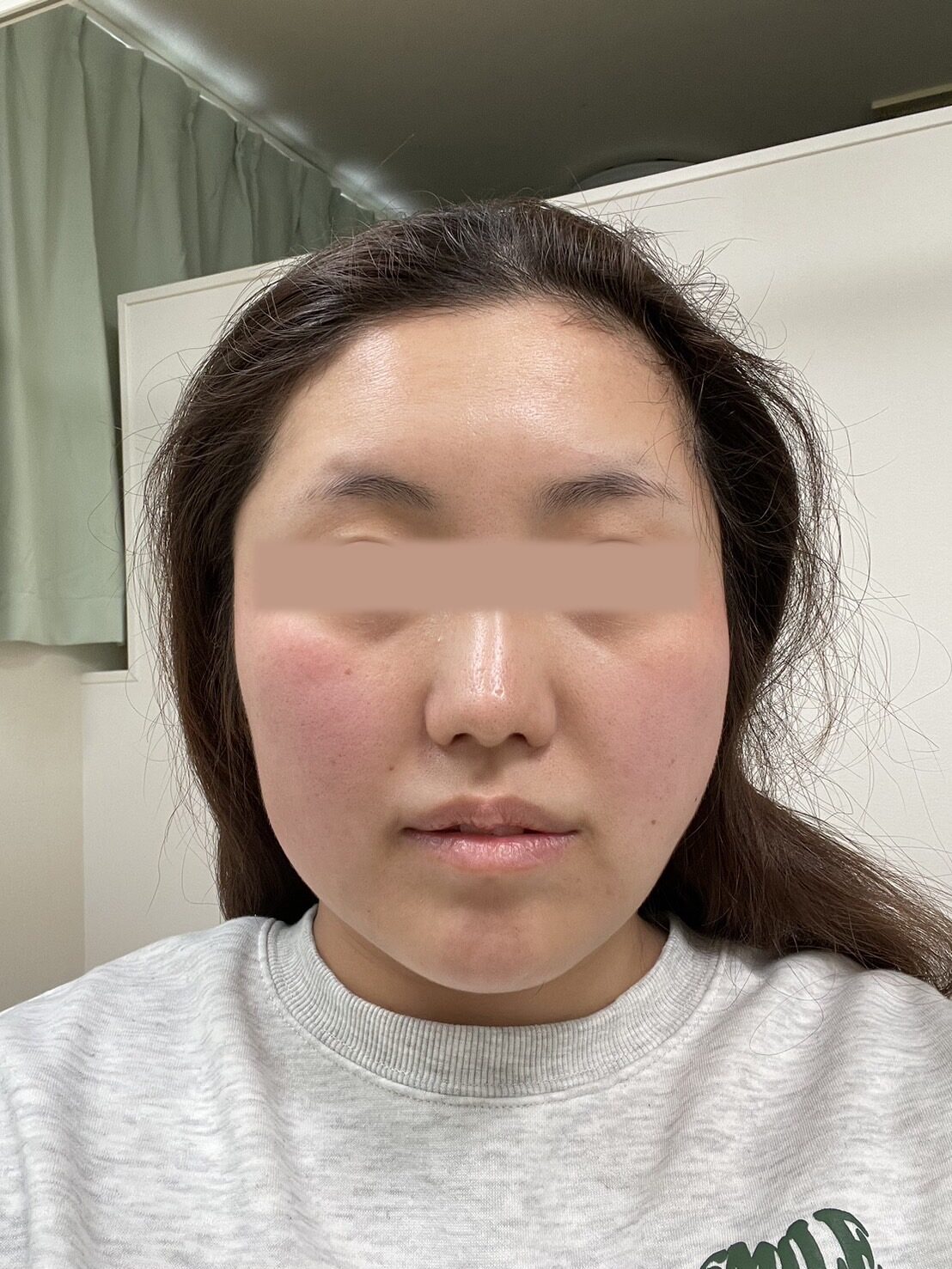 ビフォー