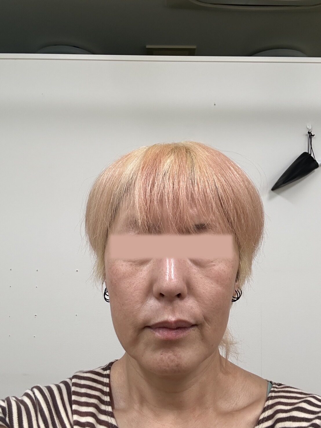 ビフォー