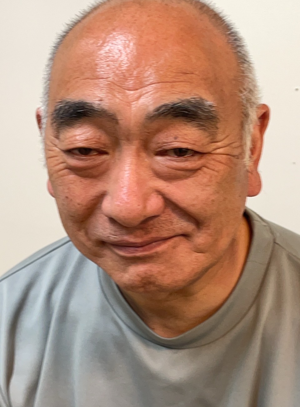 63歳M様男性のお客様の声の写真