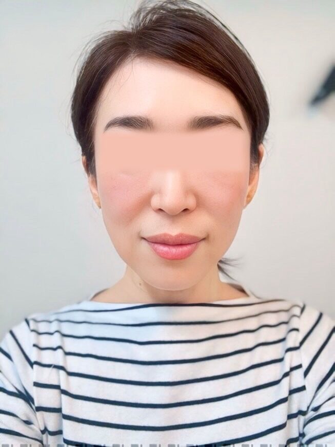 ビフォー
